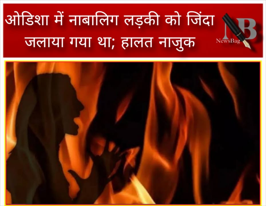 ओडिशा में नाबालिग लड़की को जिंदा जलाया गया था; हालत नाजुक