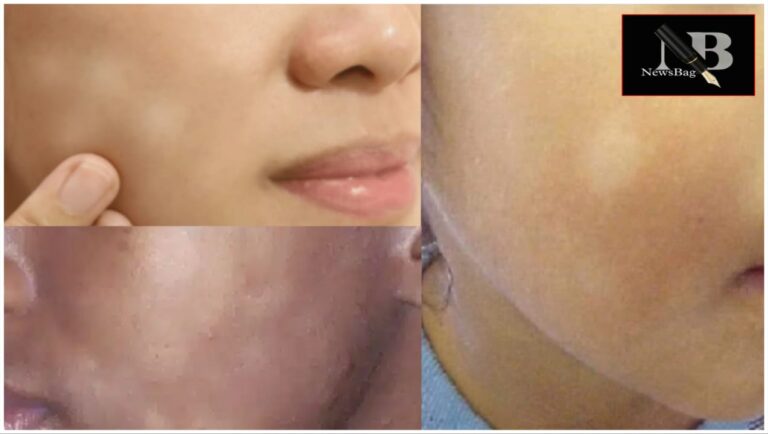 WhatsApp Image 2026-03-18 at 8.30.08 AM